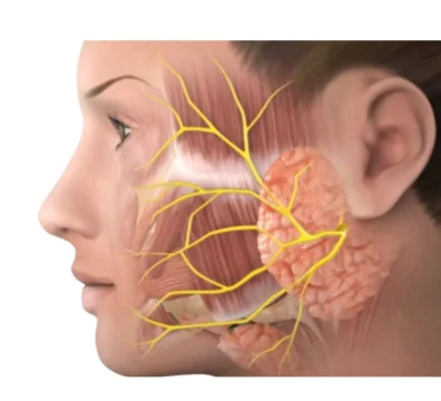 Parotid tumor treatment in Bangalore