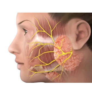 Parotid tumor treatment in Bangalore