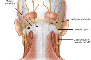 occipital_nerves