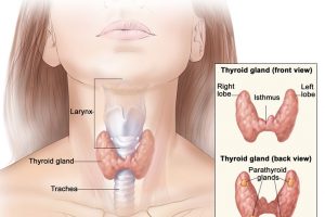 thyroid-disease-1